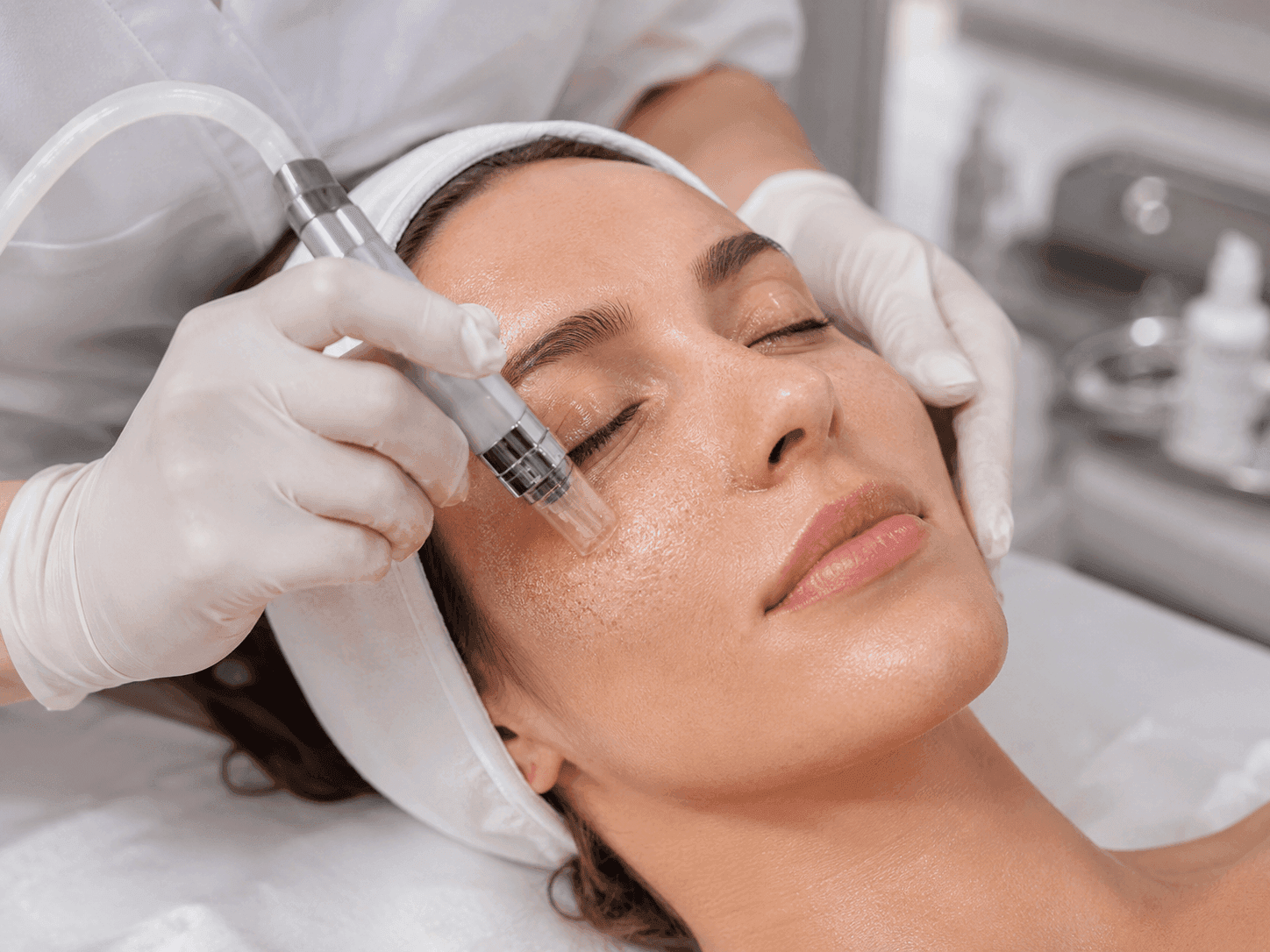 Limpieza Facial Profunda con Microdermoabrasión